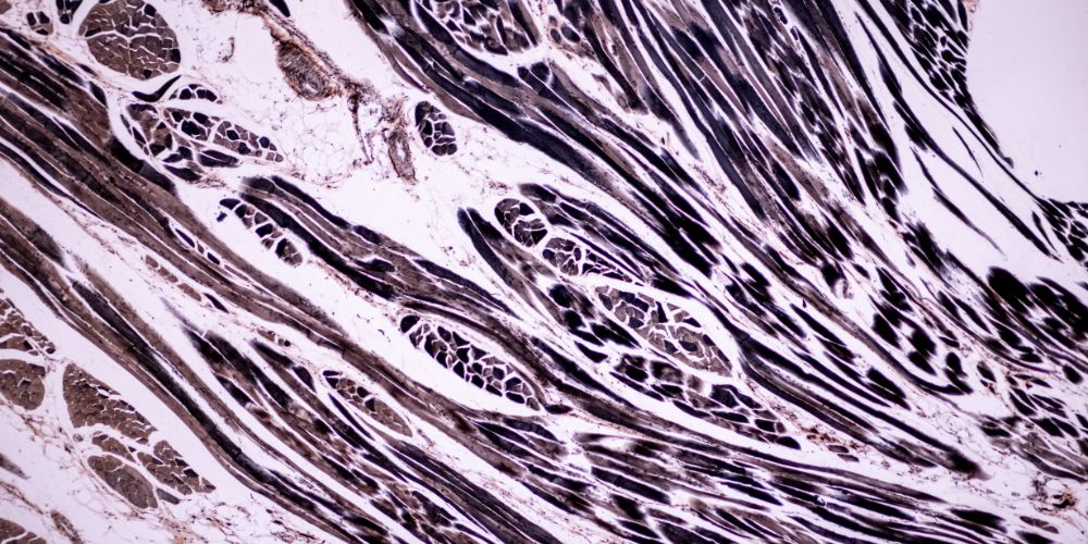 Histological sample Skeletal muscle mammal Tissue microscope