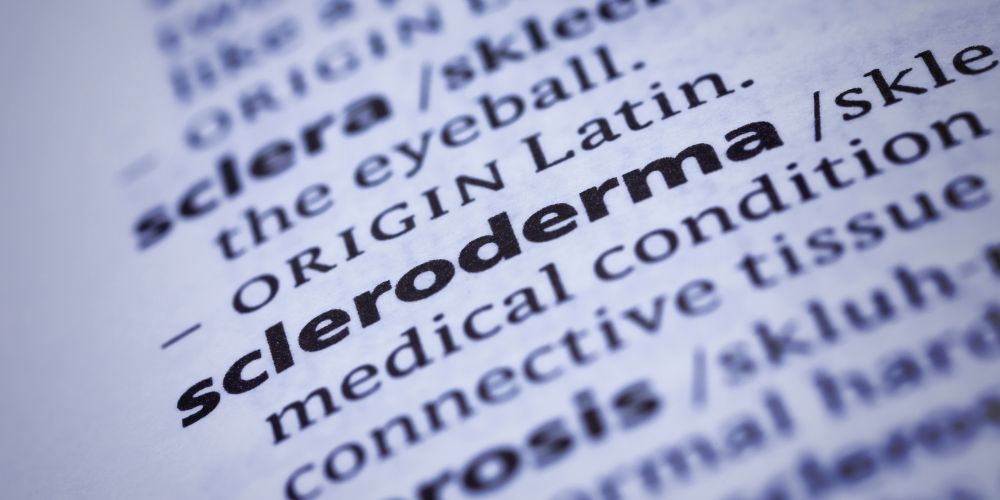 Scleroderma-erevnes.jpg