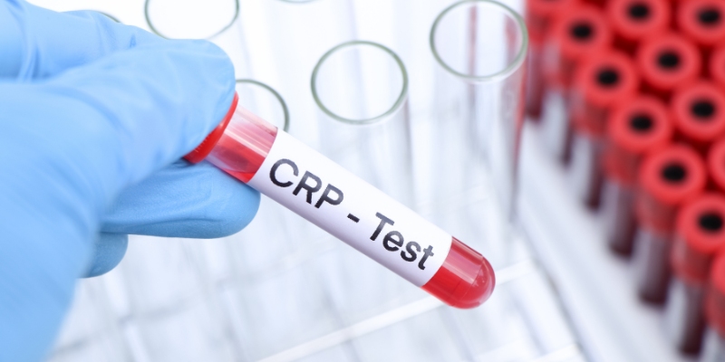 crp-inflamation.jpg
