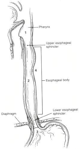 dysphagia