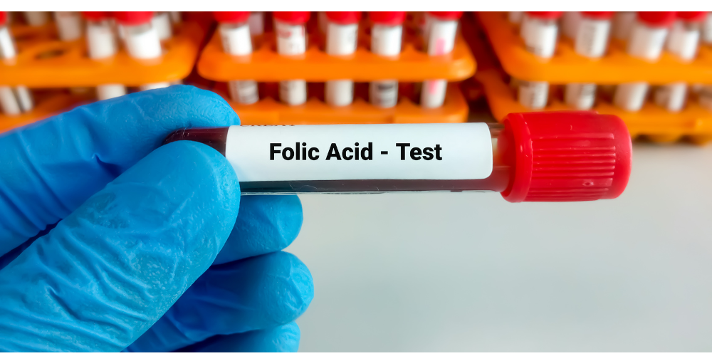 folate test