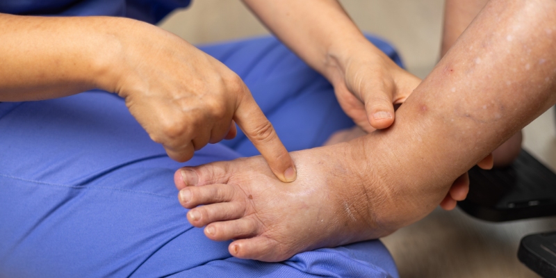 lipoidima.jpg
