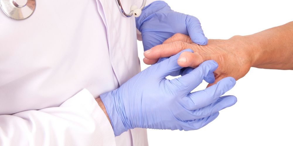 rheumatoid arthritis examination