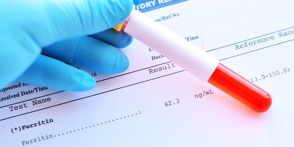 serum ferritin