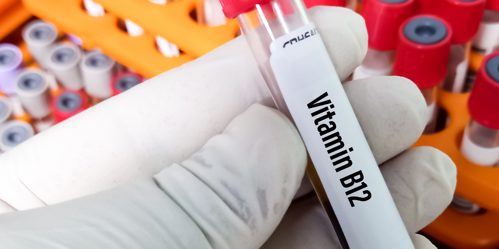 vitamin B12 test