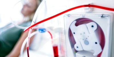 diatrofi kata tin aimokatharsi