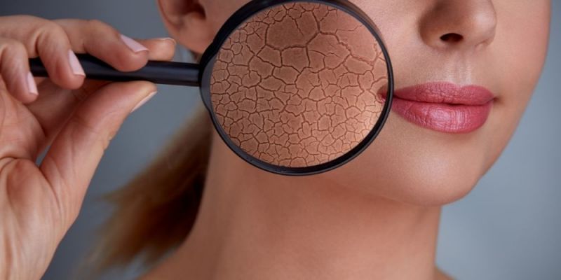 type skin