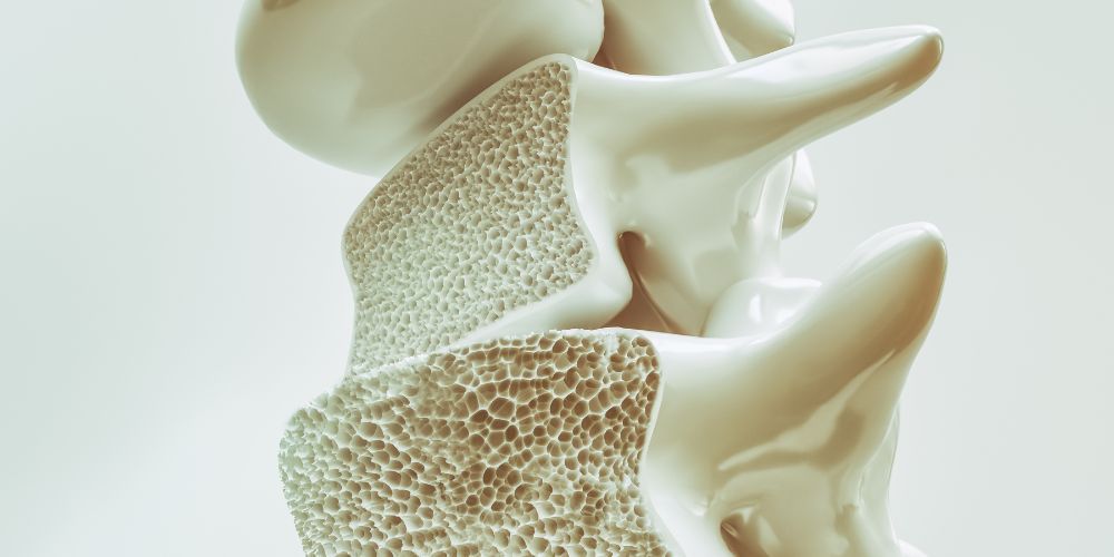 proslipsis proteinis stin anaptyksi tis osteoporosis