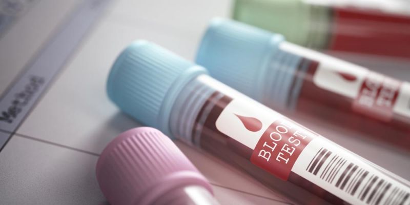 &Epsilon;&pi;ί&sigma;&eta;&mu;&eta; &alpha;&pi;ό&phi;&alpha;&sigma;&eta; &gamma;&iota;&alpha; &tau;&alpha; &tau;&epsilon;&sigma;&tau; &delta;&upsilon;&sigma;&alpha;&nu;&epsilon;&xi;ί&alpha;&sigmaf;