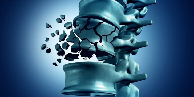 &Epsilon;&pi;ώ&nu;&upsilon;&mu;&omicron;&iota; &kappa;&alpha;&iota; &Omicron;&sigma;&tau;&epsilon;&omicron;&pi;ό&rho;&omega;&sigma;&eta;