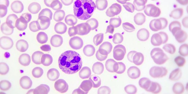 vitamini v12 kai ta lefka aimosfairia