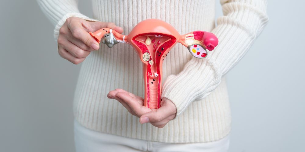 i xorigisi antiokseidotikon vitaminon c kai e borei na meiosei simantika ta symptomata ponou stin endomitriosi
