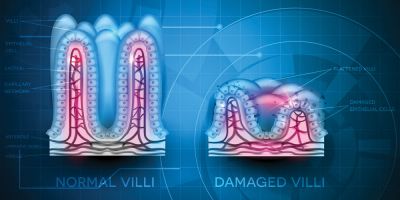 &Lambda;ά&chi;&nu;&epsilon;&sigmaf;