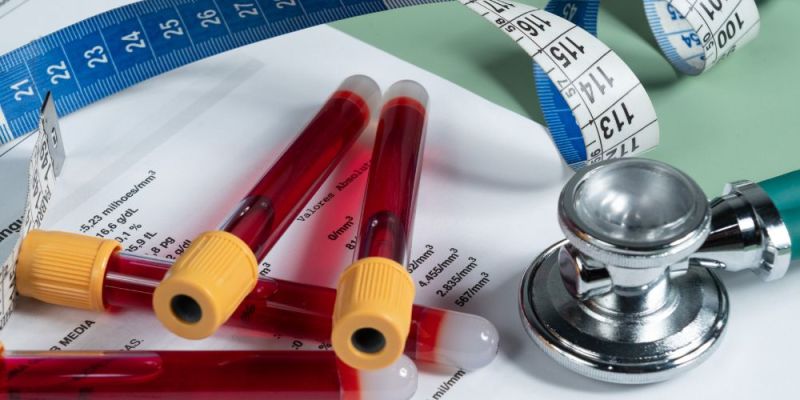 nisteia fysiki drastiriotita kai therapeia meso texnis sti veltiosi parametron tou metavolikoy syndromou kai ton epipedon flegmonosomaton