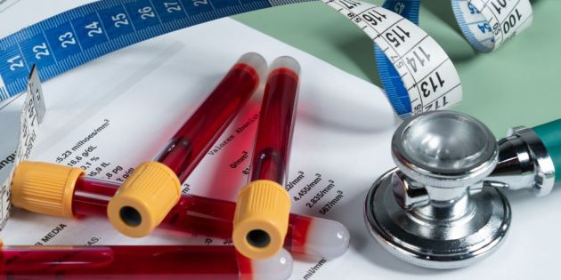 nisteia fysiki drastiriotita kai therapeia meso texnis sti veltiosi parametron tou metavolikoy syndromou kai ton epipedon flegmonosomaton