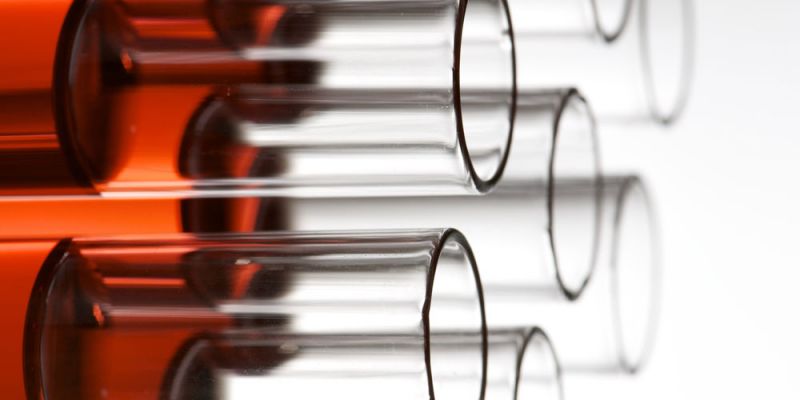 &Sigma;&iota;&delta;&eta;&rho;&omicron;&pi;&epsilon;&nu;&iota;&kappa;ή &Alpha;&nu;&alpha;&iota;&mu;ί&alpha;