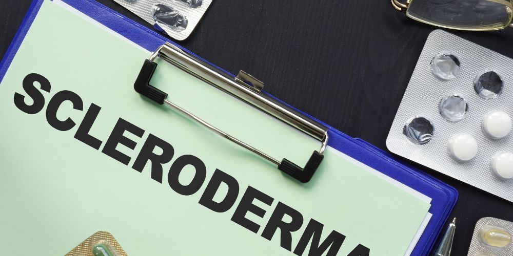 systimatiko skliroderma