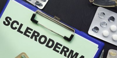 systimatiko skliroderma