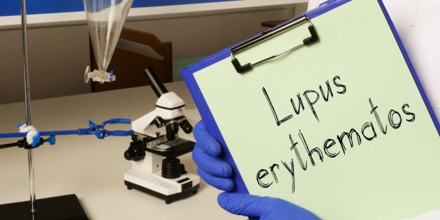 &Sigma;&upsilon;&sigma;&tau;&eta;&mu;&alpha;&tau;&iota;&kappa;ό&sigmaf; &Epsilon;&rho;&upsilon;&theta;&eta;&mu;&alpha;&tau;ώ&delta;&eta;&sigmaf; &Lambda;ύ&kappa;&omicron;&sigmaf; &kappa;&alpha;&iota; &Delta;&iota;&alpha;&tau;&rho;&omicron;&phi;ή: &pi;&omicron;&iota;&alpha; &theta;&rho;&epsilon;&pi;&tau;&iota;&kappa;ά &sigma;&tau;&omicron;&iota;&chi;&epsilon;ί&alpha; &mu;&pi;&omicron;&rho;&omicron;ύ&nu; &nu;&alpha; &beta;&omicron;&eta;&theta;ή&sigma;&omicron;&upsilon;&nu; &tau;&omicron;&nu; &alpha;&sigma;&theta;&epsilon;&nu;ή